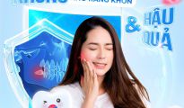Không nhổ răng khôn hậu quả gì? Những biến chứng bạn không nên chủ quan