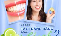 Có nên tẩy trắng răng bằng chanh? Sự thật bạn cần biết!