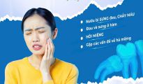 4 DẤU HIỆU RĂNG KHÔN MỌC - ĐỪNG CHỦ QUAN KHI CƠN ĐAU BẮT ĐẦU