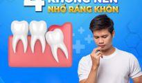 4 THỜI ĐIỂM KHÔNG NÊN NHỔ RĂNG KHÔN CẦN TRÁNH