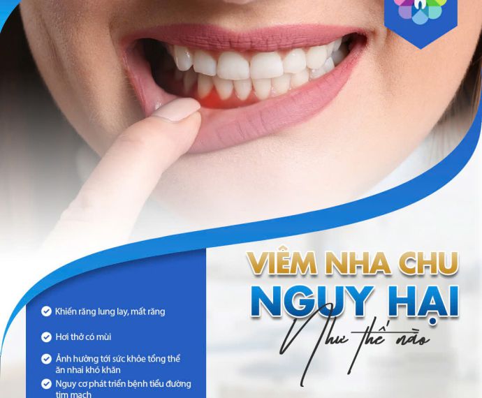 Viêm
