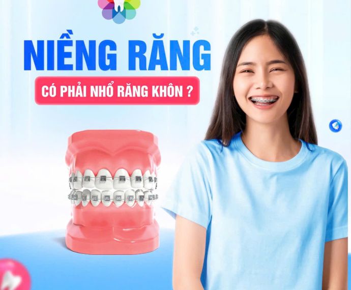 Niềng
