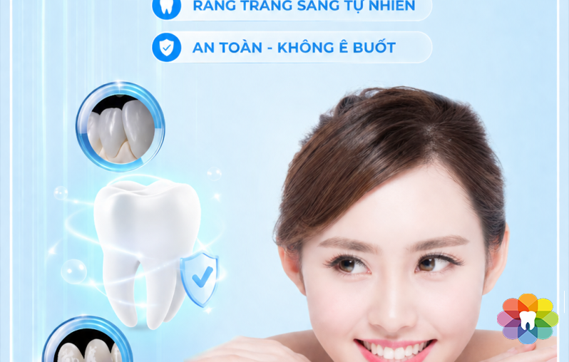 TẨY TRẮNG RĂNG AN TOÀN – LẤY LẠI NỤ CƯỜI RẠNG RỠ