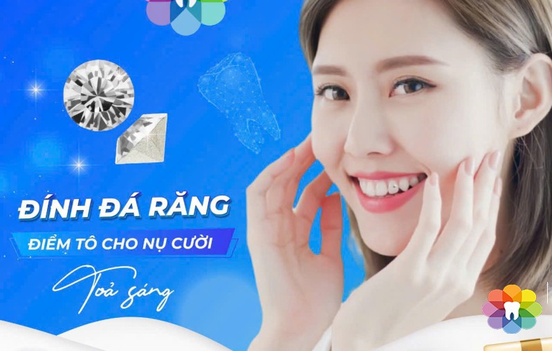 ĐÍNH ĐÁ RĂNG ĐIỂM TÔ CHO NỤ CƯỜI