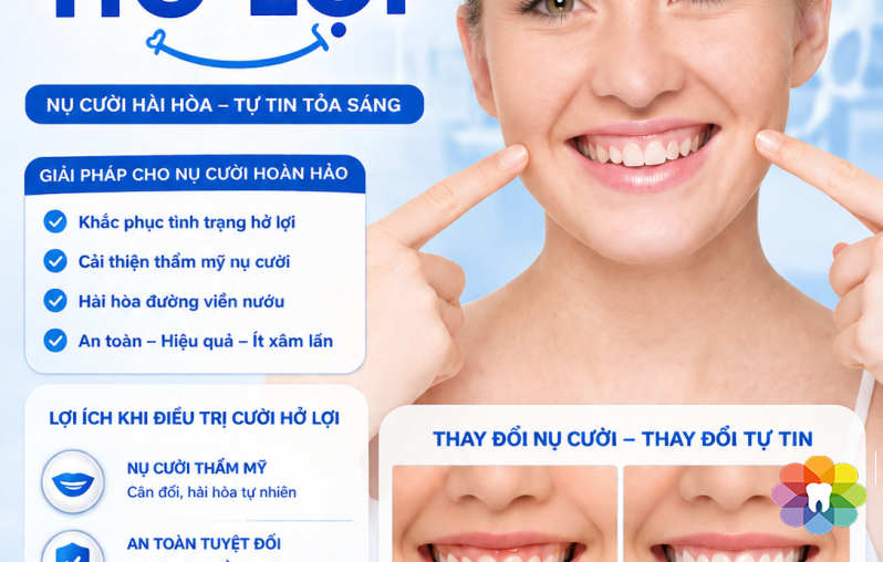CƯỜI HỞ LỢI