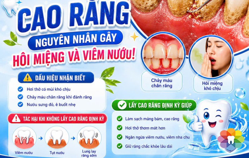 CAO RĂNG – NGUYÊN NHÂN ÂM THẦM GÂY HÔI MIỆNG VÀ VIÊM NƯỚU