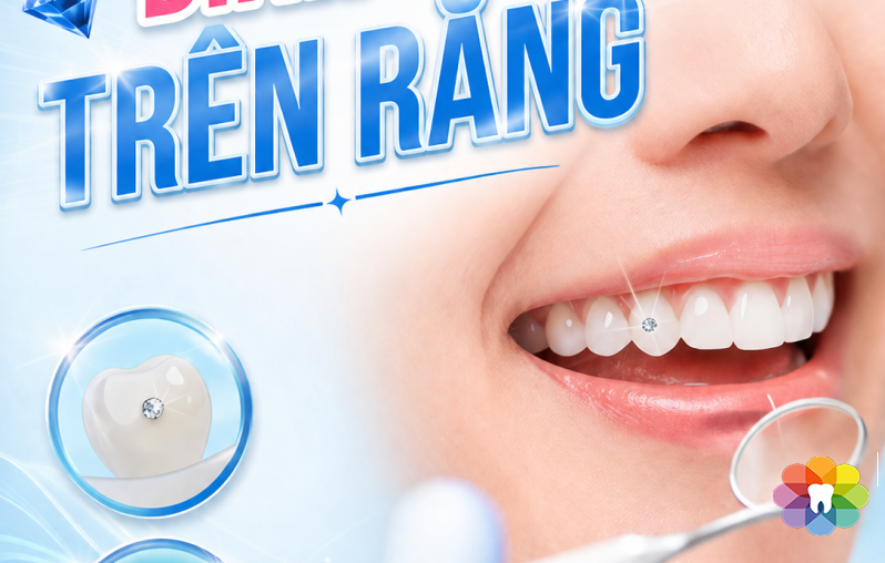 Đính Đá Trên Răng – Tỏa Sáng Nụ Cười, Khẳng Định Phong Cách