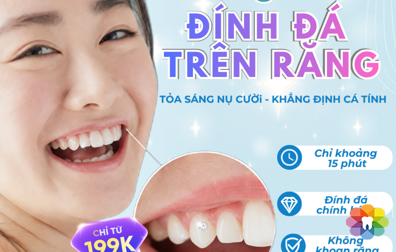 ĐÍNH ĐÁ TRÊN RĂNG TỎA SÁNG NỤ CƯỜI - KHẲNG ĐỊNH CÁ TÍNH