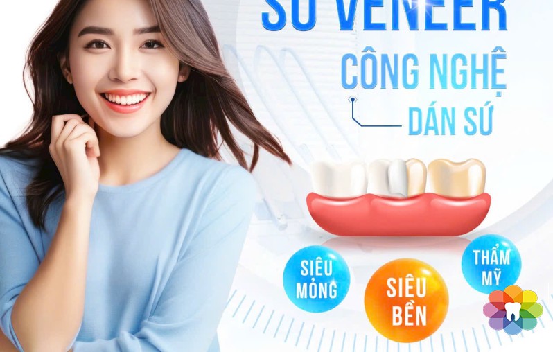 Mặt dán sứ Veneer – Phục hình răng đẹp hoàn hảo, bảo tồn răng thật tối đa