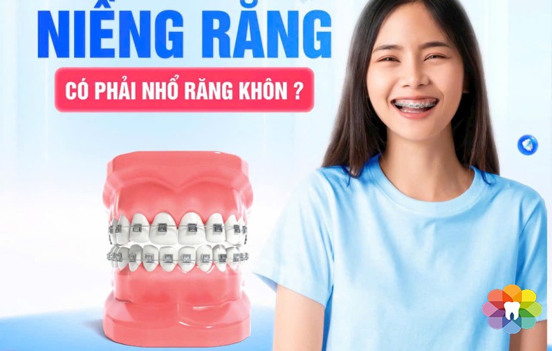 NIỀNG RĂNG - CÓ CẪN NHỔ RĂNG KHÔN