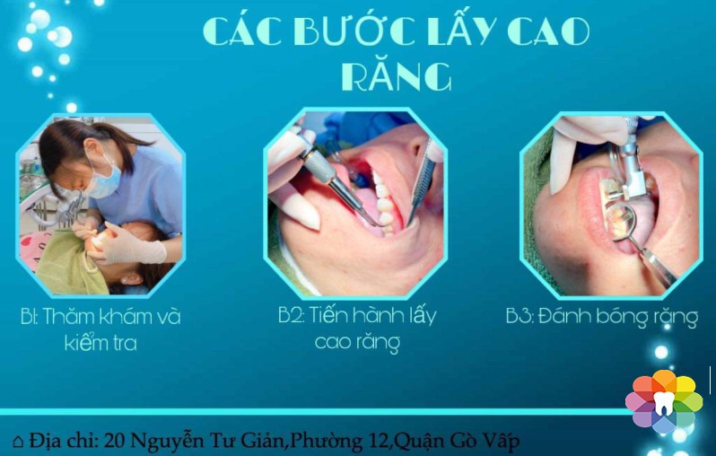 Cạo vôi răng an toàn