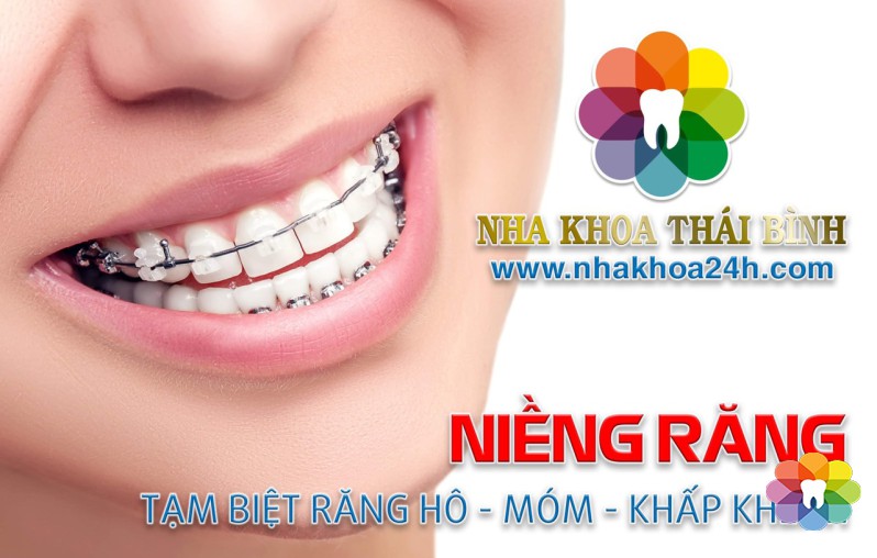 Niềng Răng Thẩm Mỹ
